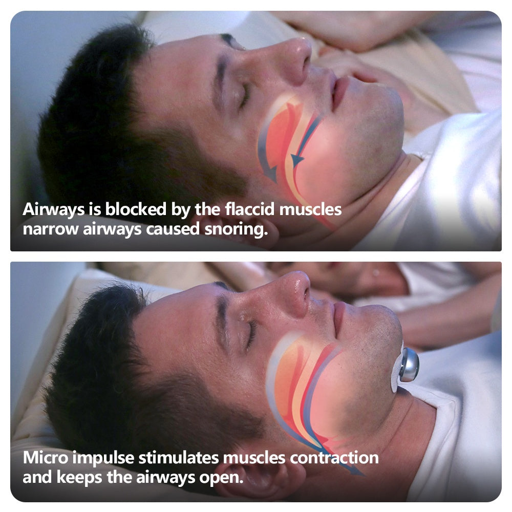 Smart Anti Snoring Device Electronic Muscle Stimulator Pro - NOMAN STORE LLC