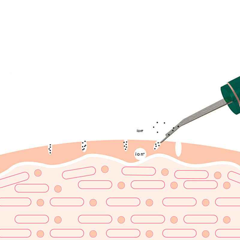 Ultrasonic Skin Rejuvenation Whitening Shoveling Machine Exfoliating Skin Care - NOMAN STORE LLC